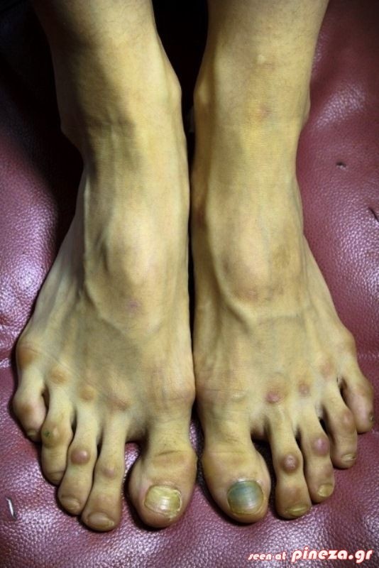 ΣΟΚ: Τα πόδια μιας επαγγελματία χορεύτριας μπαλέτου (pic)